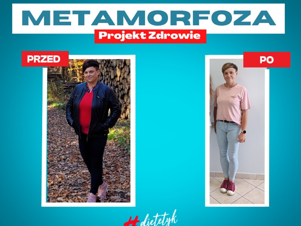 Metamorfoza w Centrum Dietetycznym Projekt Zdrowie: Pani Agnieszka schudła ponad 24 kg!