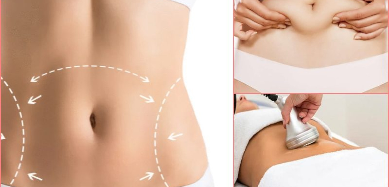  Liposukcja kawitacyjna, czyli piękna figura bez bólu i skalpela. Teraz…