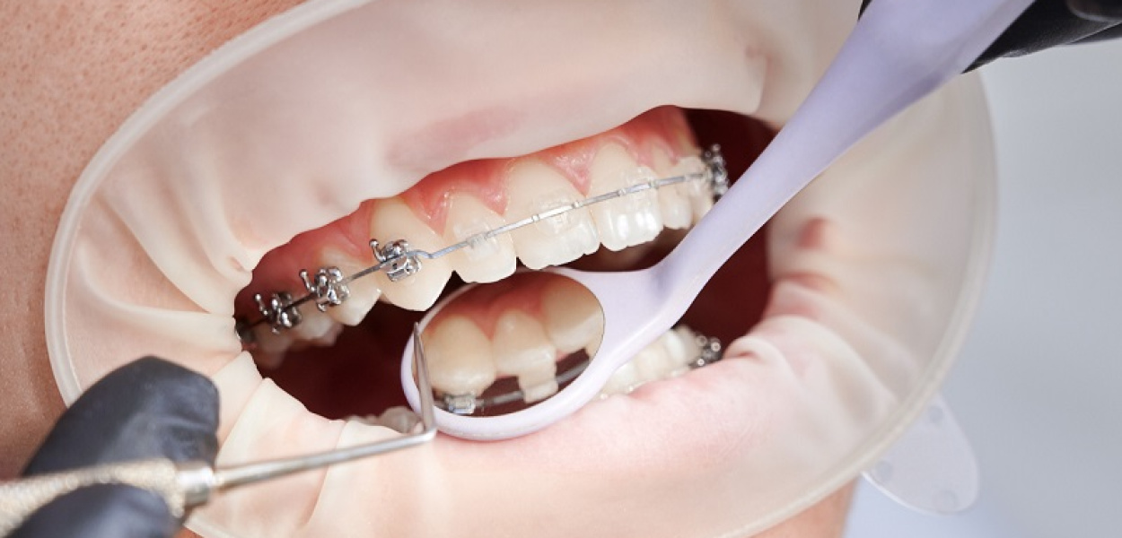 Warszawa: stomatolog a ortodonta. Na czym polega różnica? Odpowiadamy!