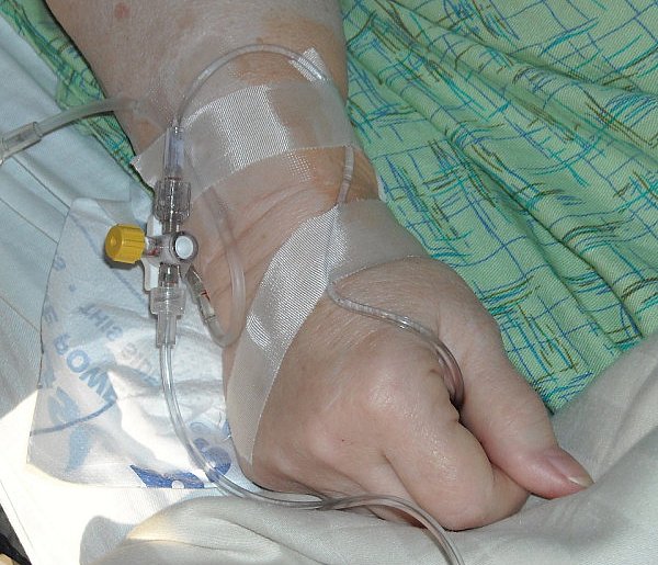 Pacjenci apelują o zmiany. Chodzi o dostęp do nowoczesnych terapii-106977