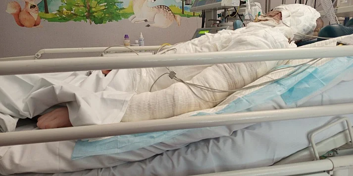 13-letni Marcel walczy o życie po porażeniu prądem. Rodzina apeluje o pomoc